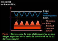 curva pletismografica oximetria de pulso a domicilio